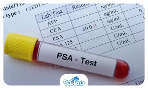 آزمایش پروستات (PSA) چیست و چه زمانی تجویز می‌‌شود؟ تفسیر کامل تست psa