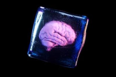 سرمازیستی ؛ ماجرای واقعی مغز یک پزشک که شبیه فیلم های علمی تخیلی است! (+عکس)