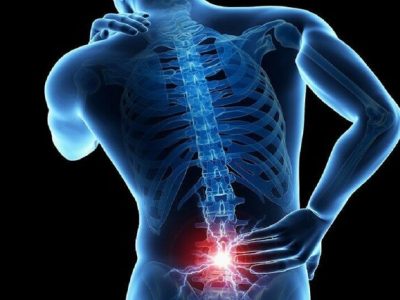 تجربه کمردرد در ۸۰ درصد افراد / کدام کمردردها باید جراحی شوند؟