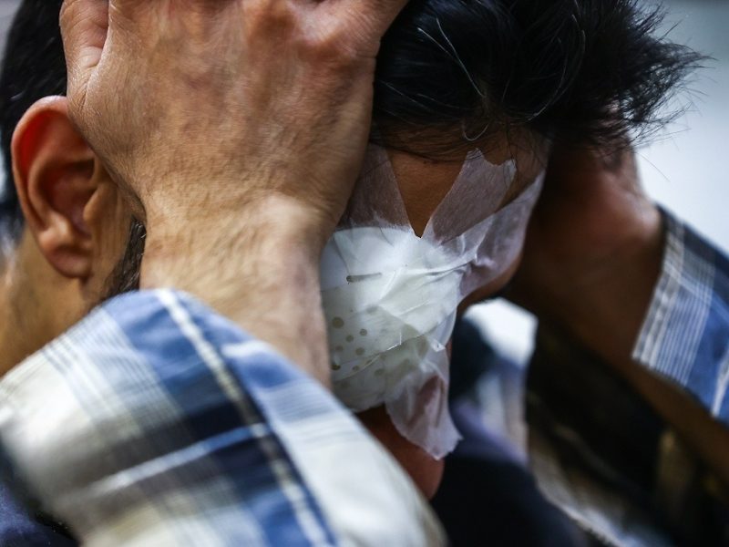 آخرین آمار حوادث چهارشنبه سوری؛ ۱۵ فوتی، ۹۳۳ آسیب چشمی و ۱۷۲ قطع عضو / پرتاب نارنجک به سمت ۶ آمبولانس