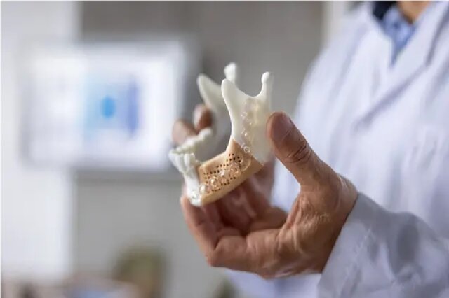 استفاده از شیشه به جای استخوان!