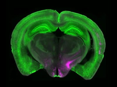 دانشمندان کلید خاموش کردن درد را کشف کردند